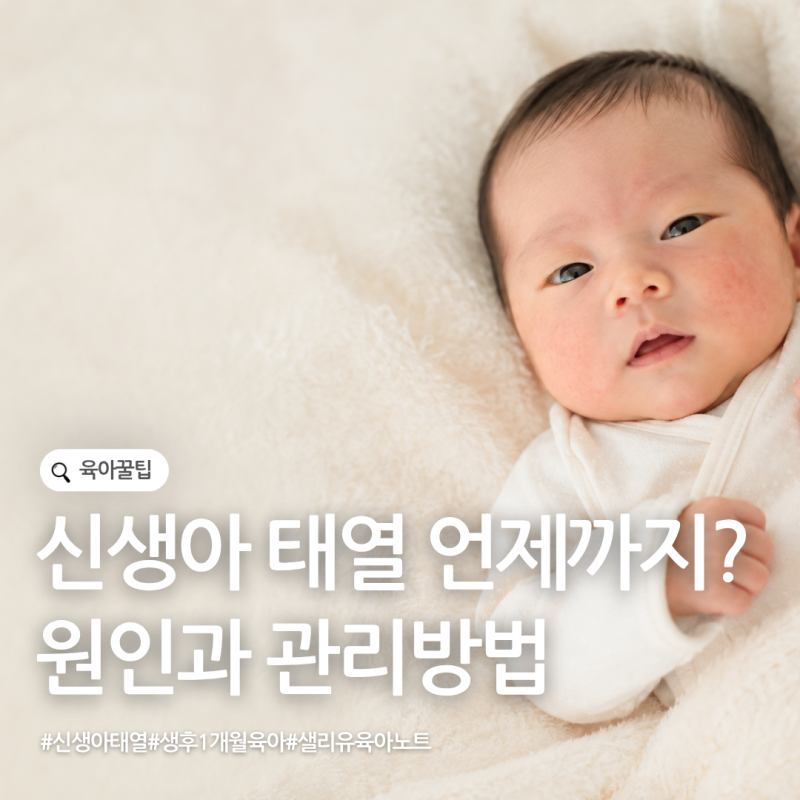 신생아 태열 언제까지? 얼굴 태열 원인과 관리방법 총정리