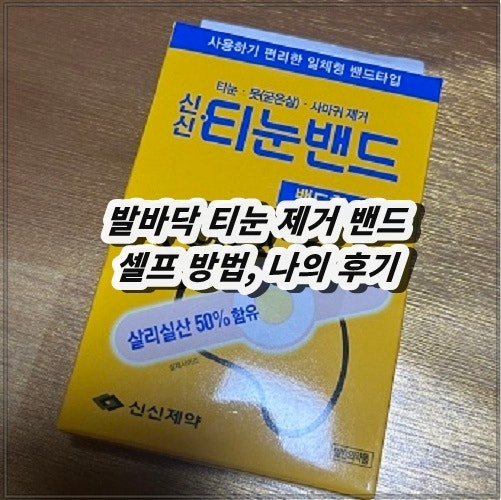 발바닥 티눈 제거 밴드 셀프 방법, 나의 후기