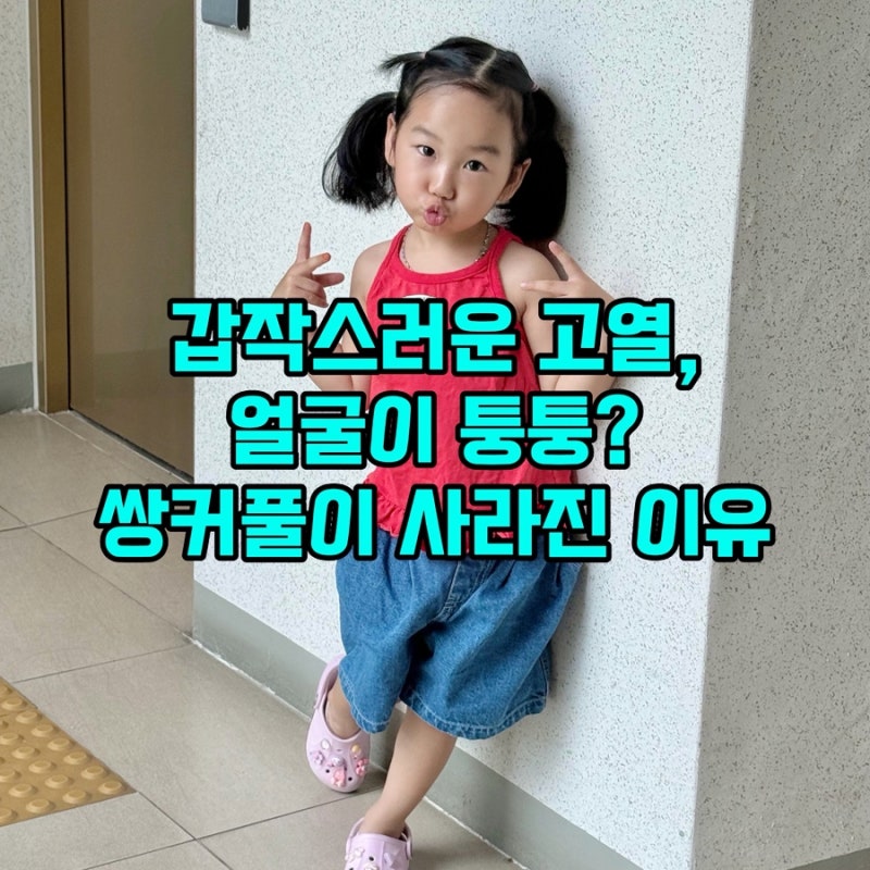 성홍열 증상 원인 전염병 격리 입원 치료 실비 후기