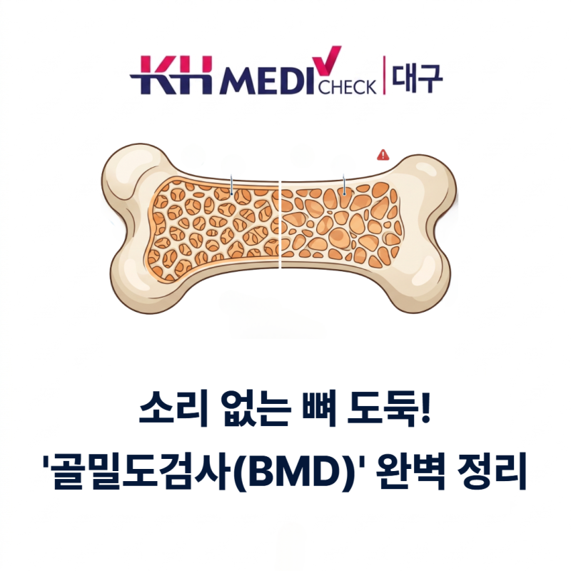 [대구건강검진] 소리 없는 뼈 도둑! 중년 여성을 위한 '골밀도검사(BMD)' 완벽 정리