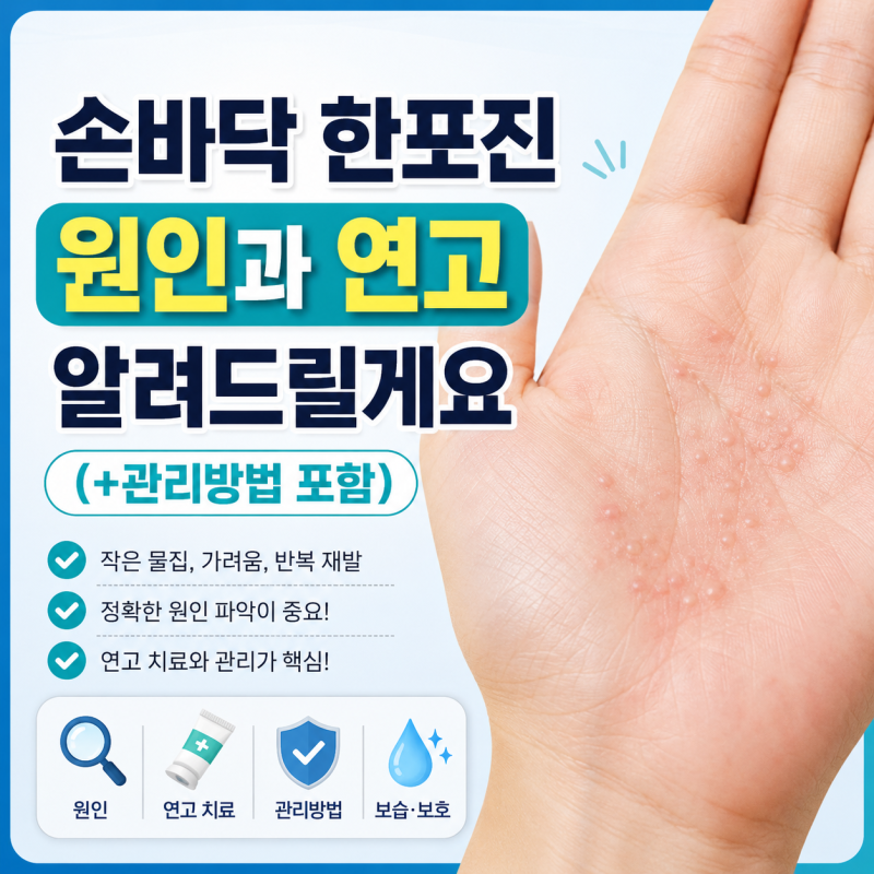 손바닥 한포진 원인과 연고 알려드릴게요(+관리방법 포함)