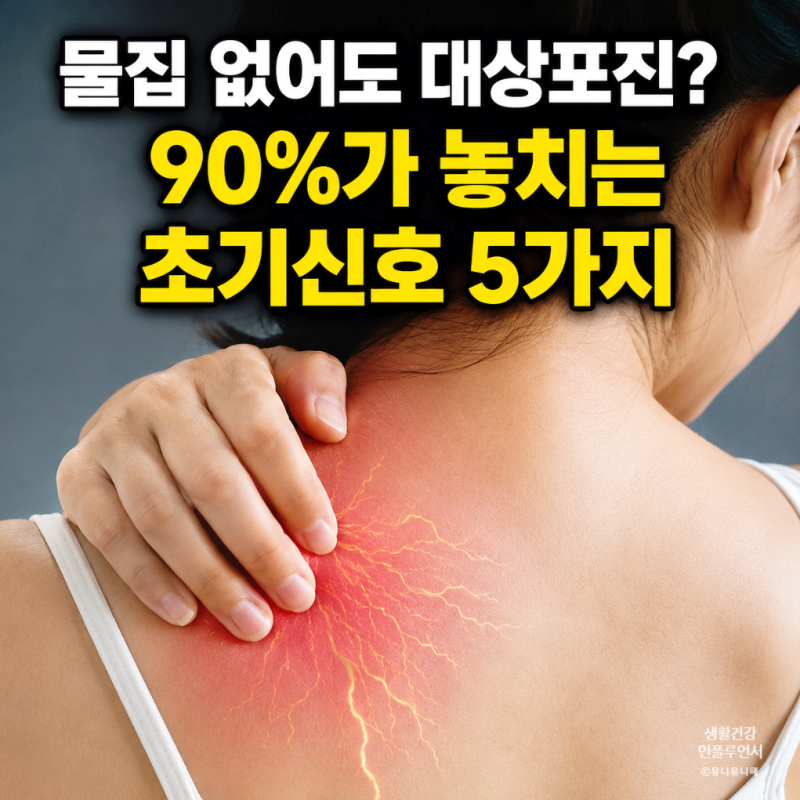 대상포진 증상 물집부터? 전염성까지 대부분 잘못 알고 있는 초기증상 5가지