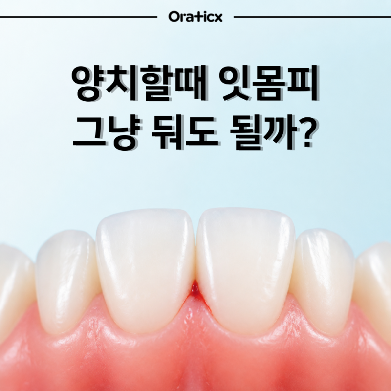 양치할 때 잇몸피 나는 이유, 반복되는 잇몸출혈 그냥 둬도 될까?