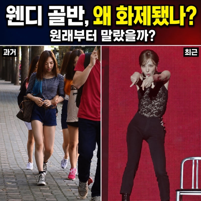 레드벨벳 웬디 골반 이슈｜패드 의혹부터 체중 변화·추락 사고·과거 논란까지