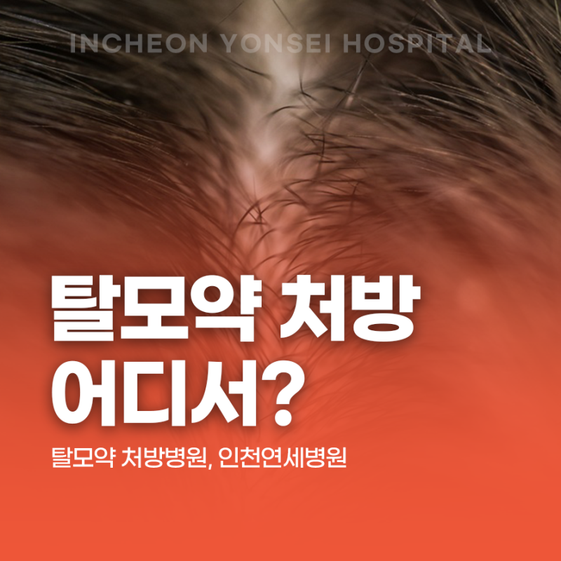 인천 탈모약 처방 어디서 받을 수 있을까요? 인천연세병원에서도 가능합니다