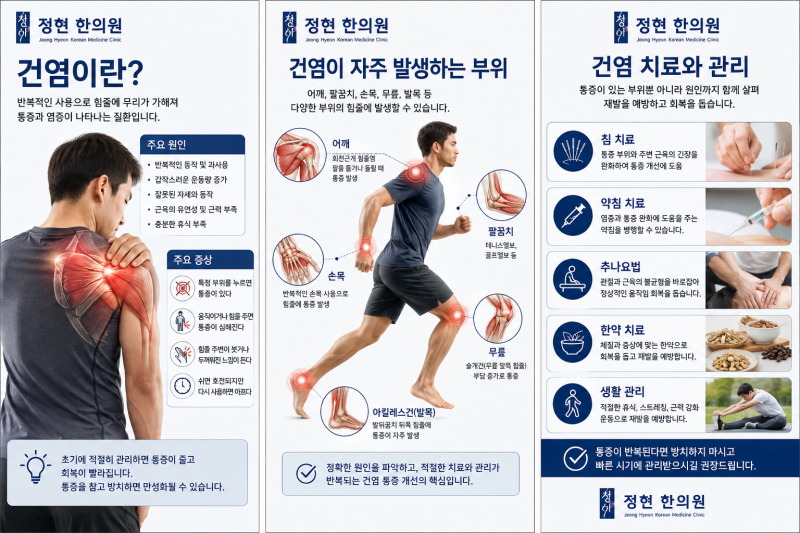 [동작구상도동숭실대역1번출구바로앞정현한의원] 어깨·팔꿈치·무릎·아킬레스건 통증이 반....