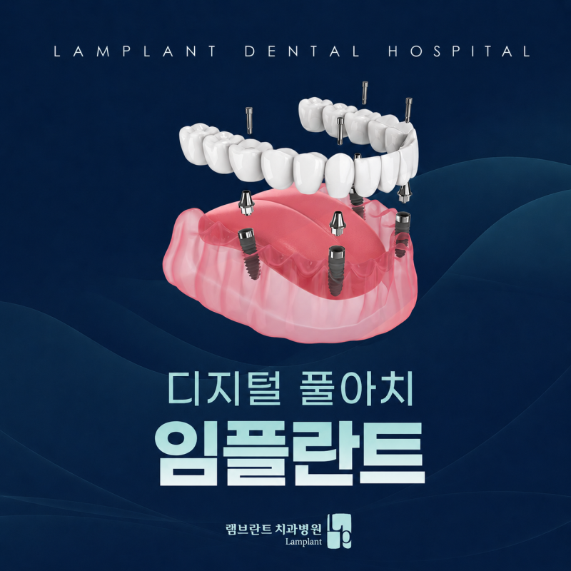 창원전체임플란트 비용이 부담된다면 꼭 알아야 할 치료법