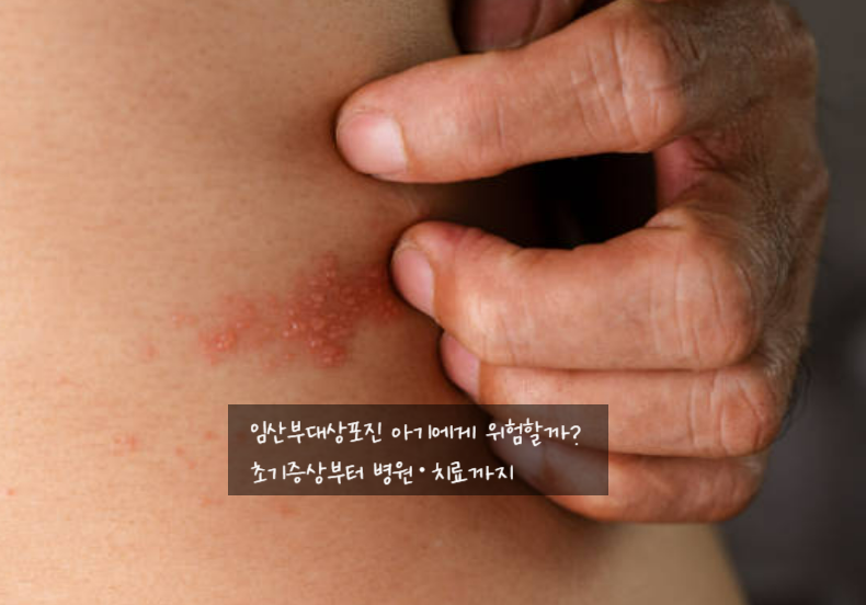 임산부대상포진 아기에게 위험할까? 초기증상부터 병원 치료까지