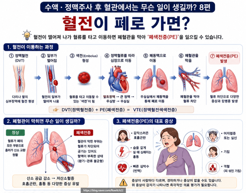혈전이 폐로 가면 무슨 일이 생길까ㅣ폐색전증 증상은 ⑧