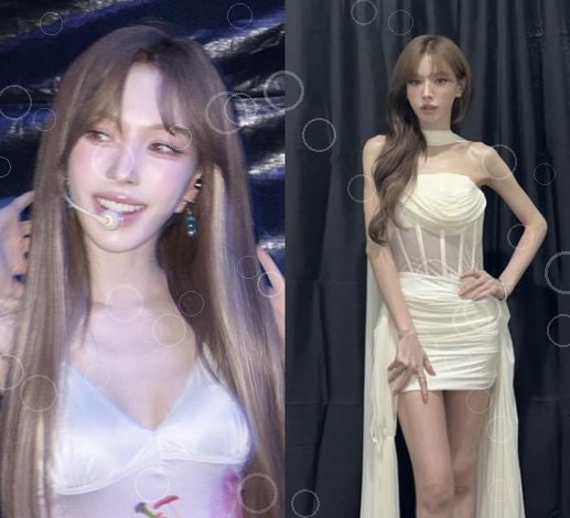웬디 골반 패드 의혹, 걱정이 조롱으로 뒤집힌 사이 무슨 일이 있었나