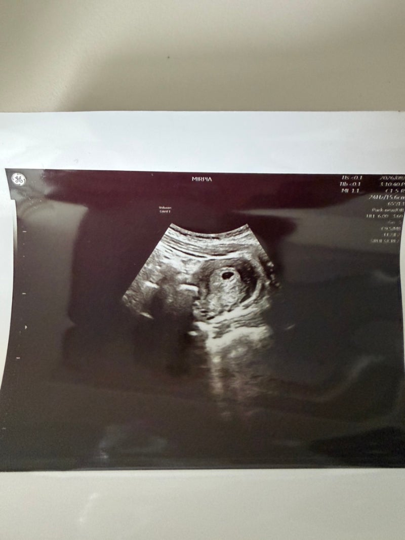 [임신 7주차 (1)] 본격 입덧 시작 임신초기 산모 케어!(임산부 필수 영양제 조합, 아토팜 튼살....