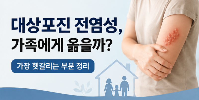 대상포진전염성, 가족에게도 옮을까? 가장 많이 헷갈리는 부분