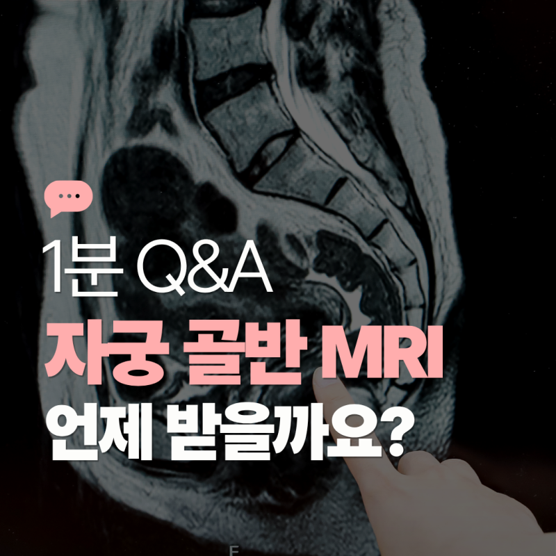 [1분 Q&A] 산부인과 자궁MRI 골반MRI 검사, 언제 찍어야 할까?