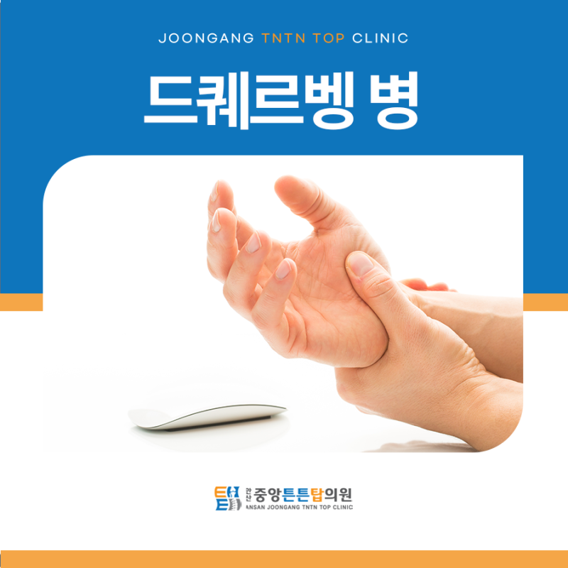 드퀘르벵 병, 엄지손가락과 손목 통증의 원인