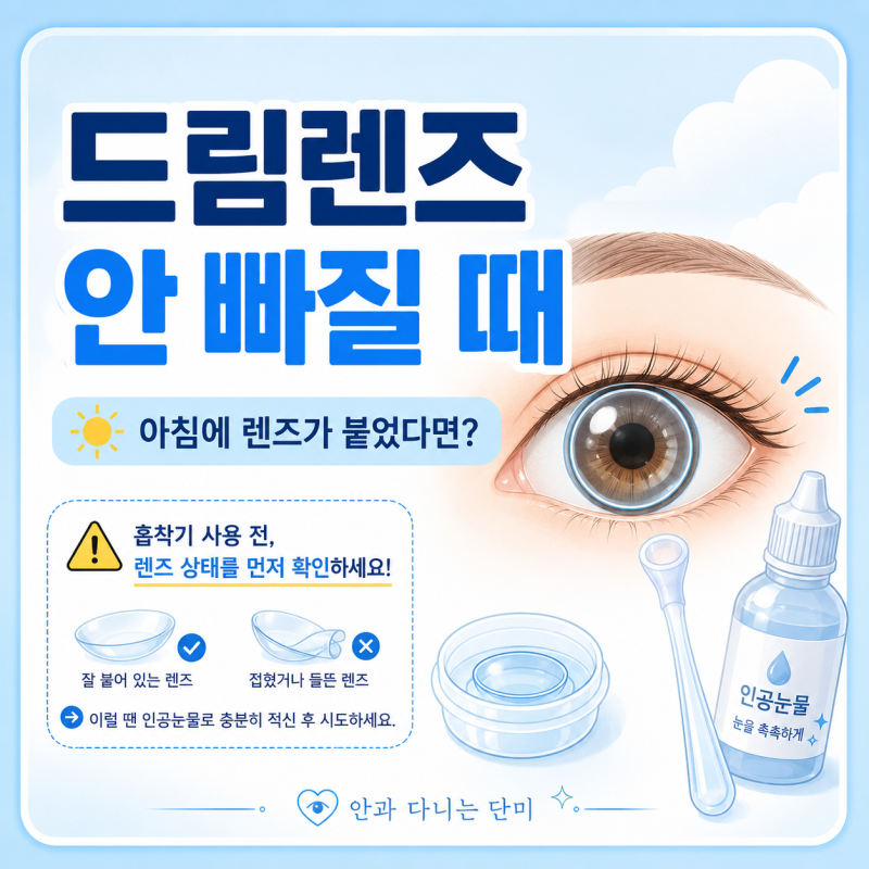 드림렌즈 안 빠질 때 어떻게 해야 할까? 아침에 렌즈가 붙었을 때 빼는 방법