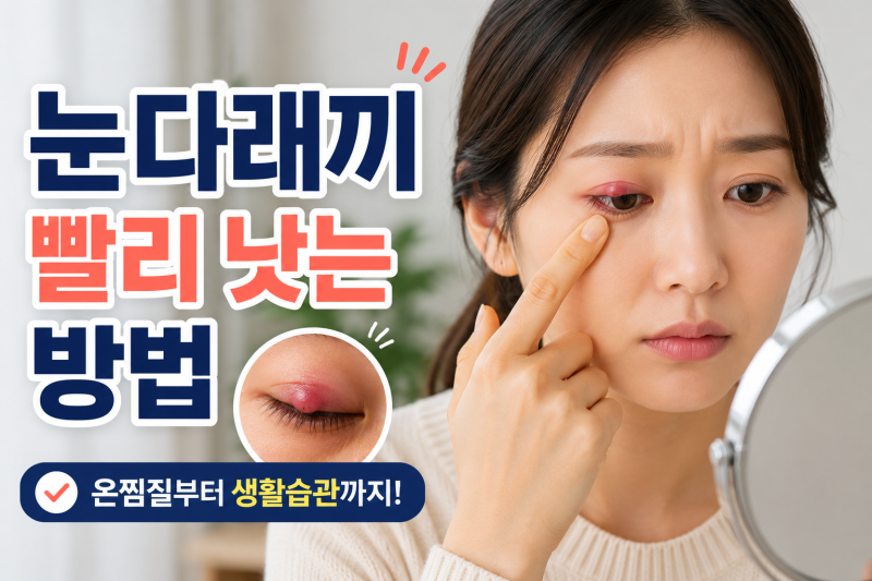 눈다래끼 빨리 낫는 방법! 초기증상부터 온찜질, 전염 여부와 병원 가야 하는 경우까지 총정....