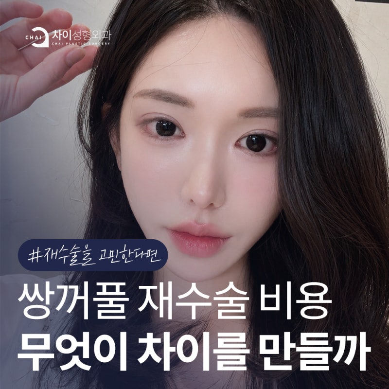 쌍꺼풀 재수술 비용, 무엇이 차이를 만들까