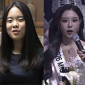 우서윤 성형 의혹, 미스코리아 성형이력 원서로 읽는 쟁점
