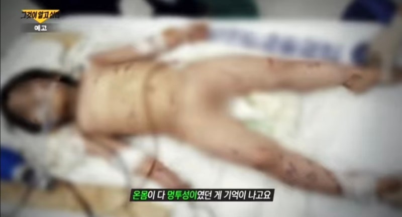 44개월 여아 의붓딸 수아 사망 사건 자매 아동 학대 범인 새엄마 계모 신상 언니