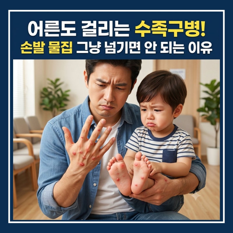 어른도 걸리는 수족구병! 손발 물집 그냥 넘기면 안 되는 이유