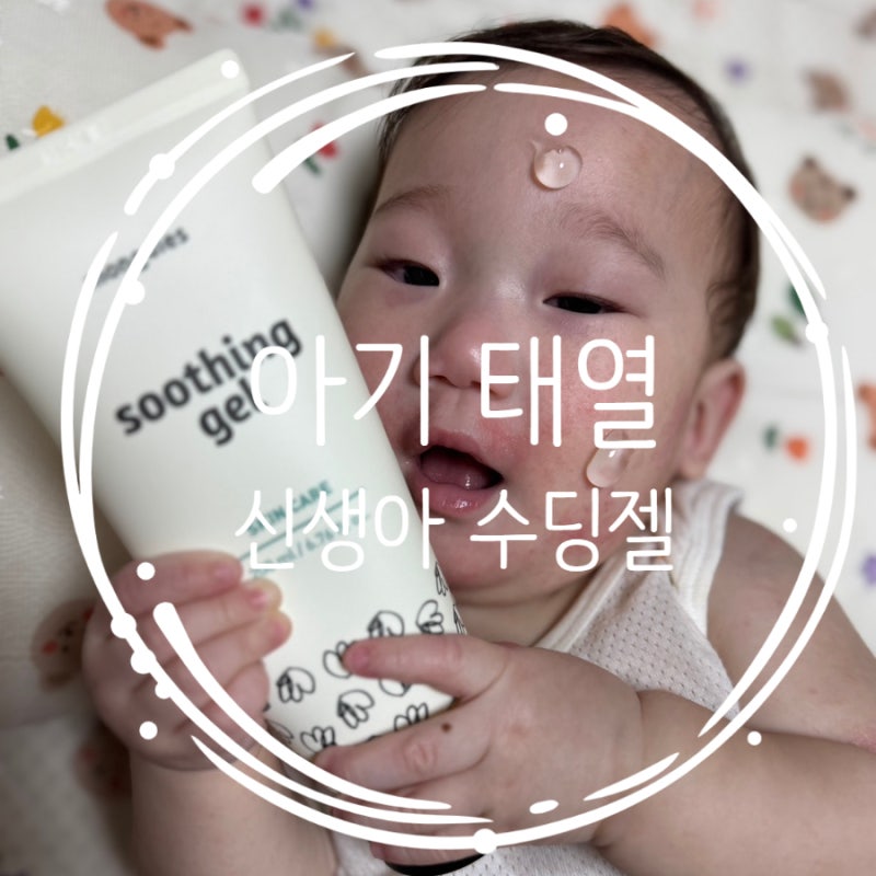 신생아 태열 초기에 잡는 법 몽디에스 신생아 수딩젤 후기