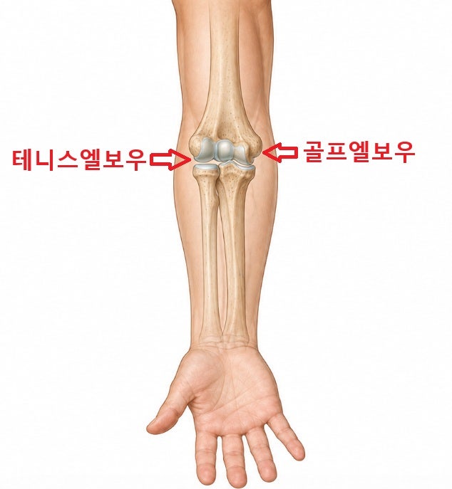 테니스엘보우 골프엘보우 치료 관리 방법 총정리, 구리청명재활의학과 수택동정형외과