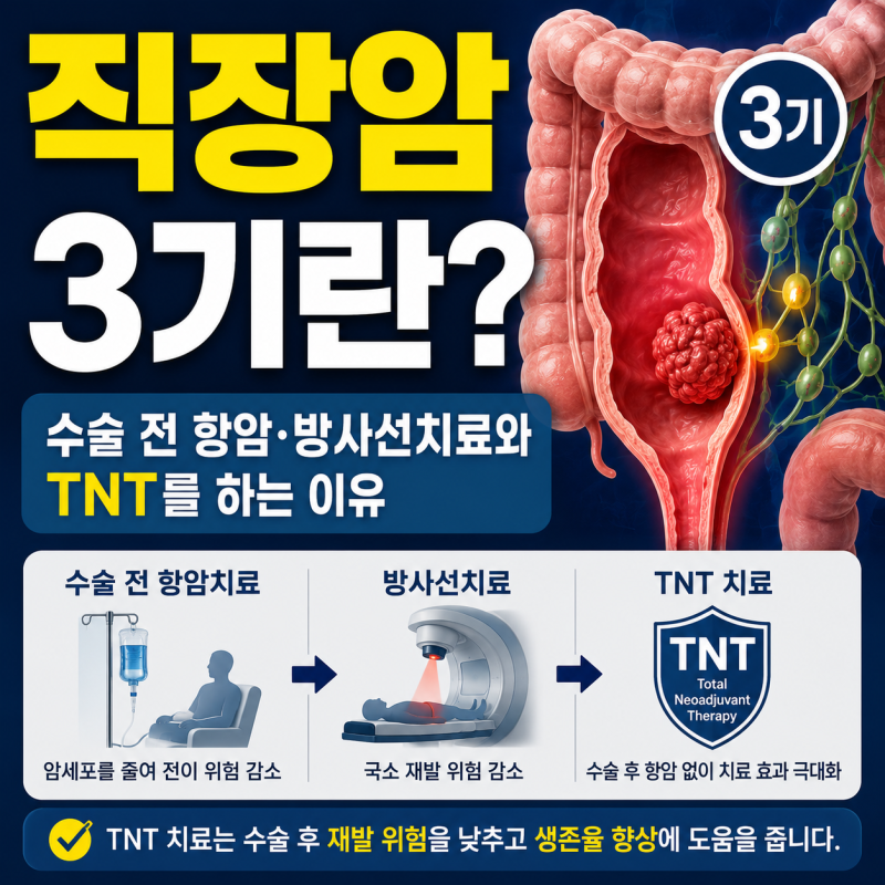 직장암 3기란? 수술 전 항암·방사선치료와 TNT를 하는 이유