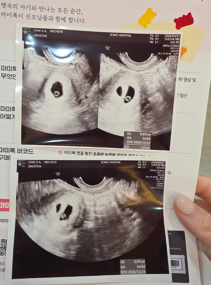 [동결 1차] 5탄 마미톡 바코드 등록, 2개 통합, 분실, 재발급 방법, 주수별 아기크기 심박수