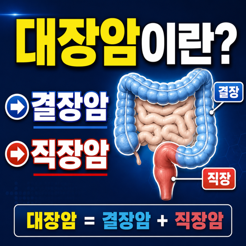 대장암은 결장암과 직장암으로 나뉩니다｜위치·검사·치료가 달라지는 이유