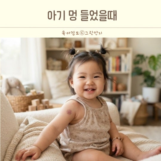 아기 멍 연고 발라줘도 될까? 아기 머리 부딪혔을 때 대처법