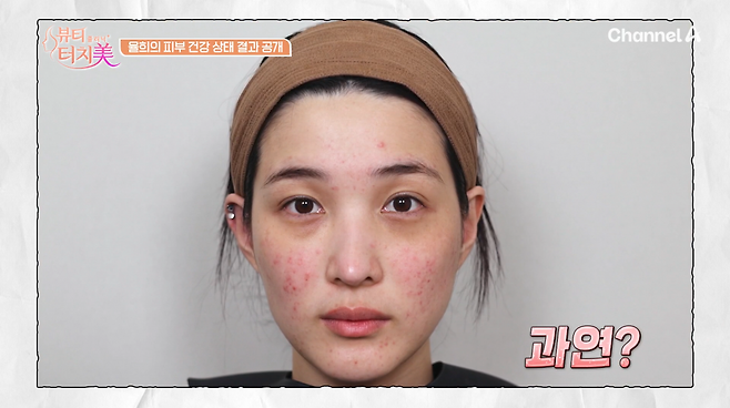"걸그룹 비주얼 어디로?" 라붐 시절 미모 어디 갔나 했더니... 율희가 민낯 드러내고 눈물겨운....