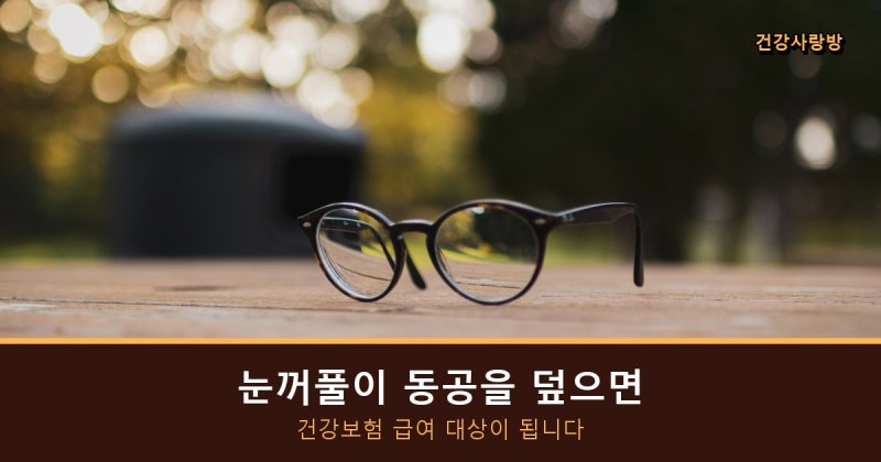 안검하수, 눈꺼풀이 동공을 덮으면 건강보험이 됩니다 (급여 기준과 안 되는 경우)