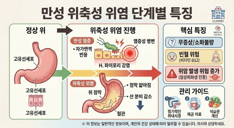 위축성 위염, 그냥 위염과 다릅니다원인부터 증상, 치료 약물과 위암 위험까지 알아보기