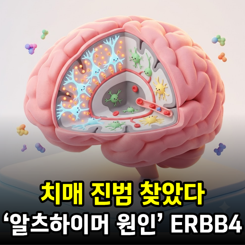 치매 ‘알츠하이머 원인’ 진범 찾았다…‘아밀로이드 베타’보다 ERBB4가 문제, 근본 치료 ....