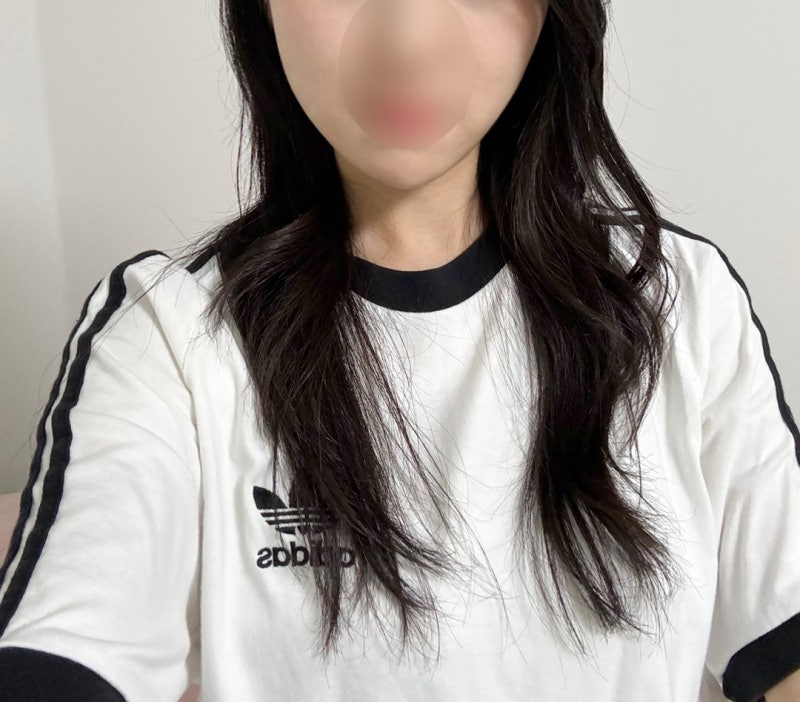 긴얼굴 양악수술이 무서워서 선택한 원컷턱끝축소