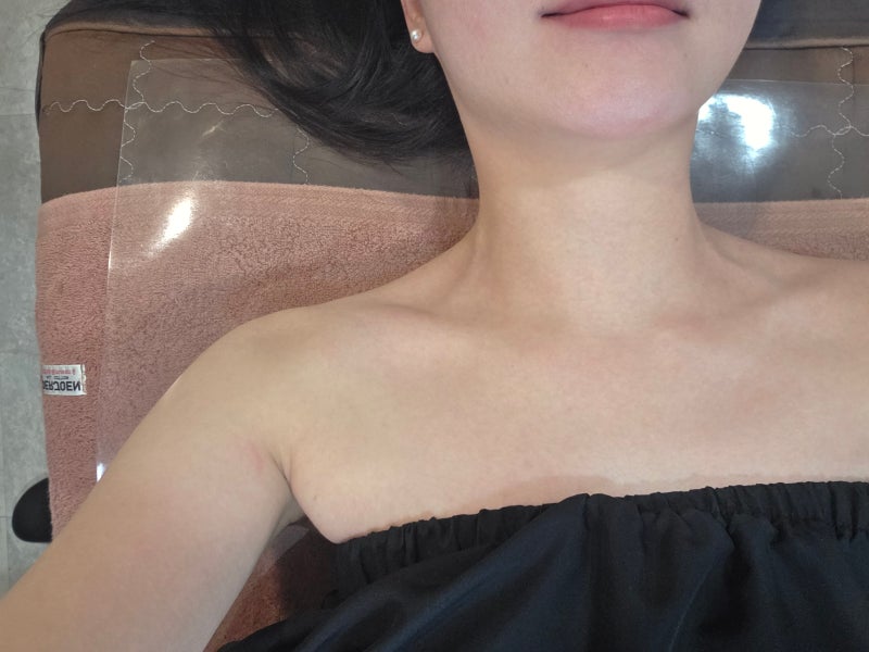 예신관리 겨드랑이 레이저 제모 2차 통증 후기