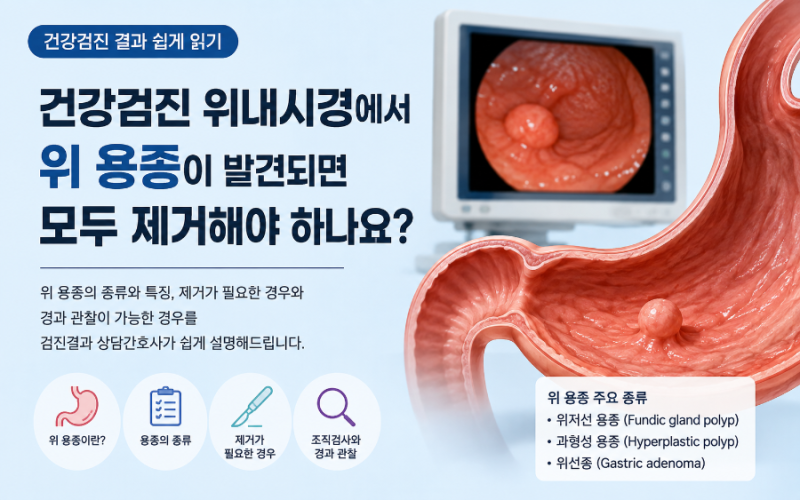 건강검진 위내시경에서 위 용종이 발견되면 모두 제거해야 하나요?건강검진 결과 쉽게 읽기