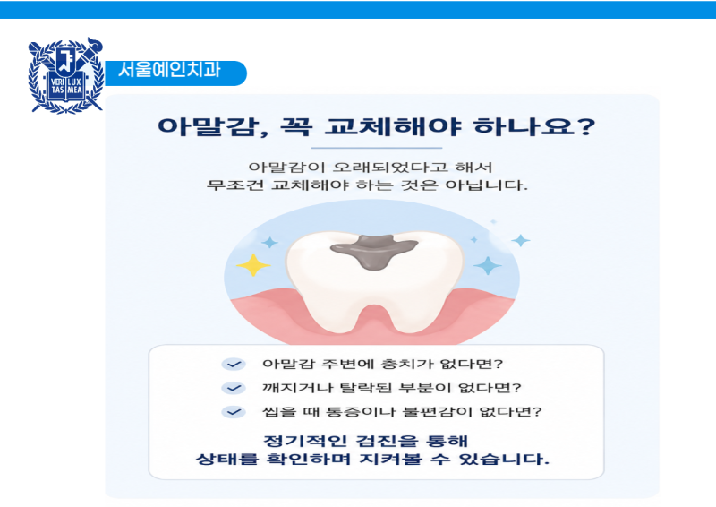 [북가좌동치과] 오래된 아말감, 꼭 교체해야 할까요? 교체가 필요한 경우 알아보기