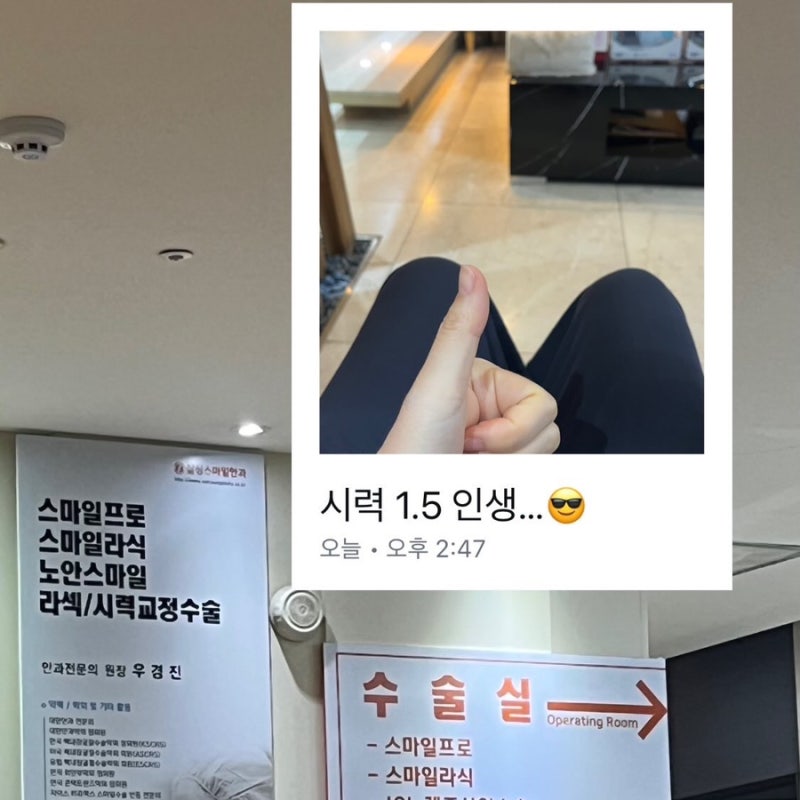 대전 삼성스마일안과 스마일라식 후기 2탄