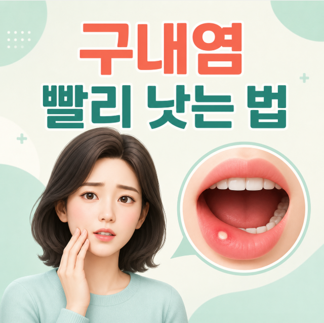 구내염 빨리 낫는 법, 연고·가글·음식 관리와 병원 가야 할 신호