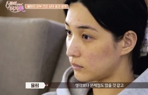 "아이들은 남편이 키우는데?" 율희가 피부 고민 털어놨다가 뜻밖의 논란에 휩사인 이유