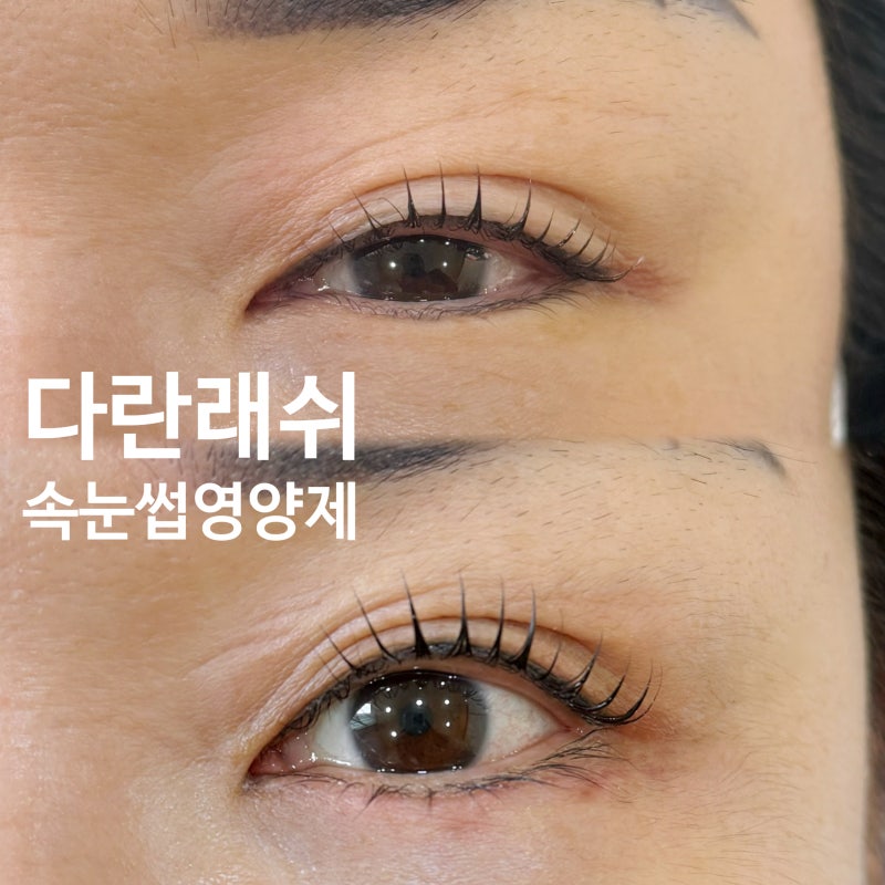 에보아이 속눈썹영양제 효과 있을까? 속눈썹 원장의 솔직후기(+정품최저가링크)