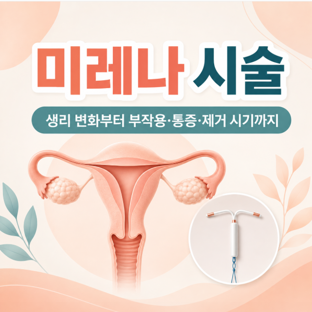 미레나 시술, 생리 변화부터 부작용·통증·제거 시기까지
