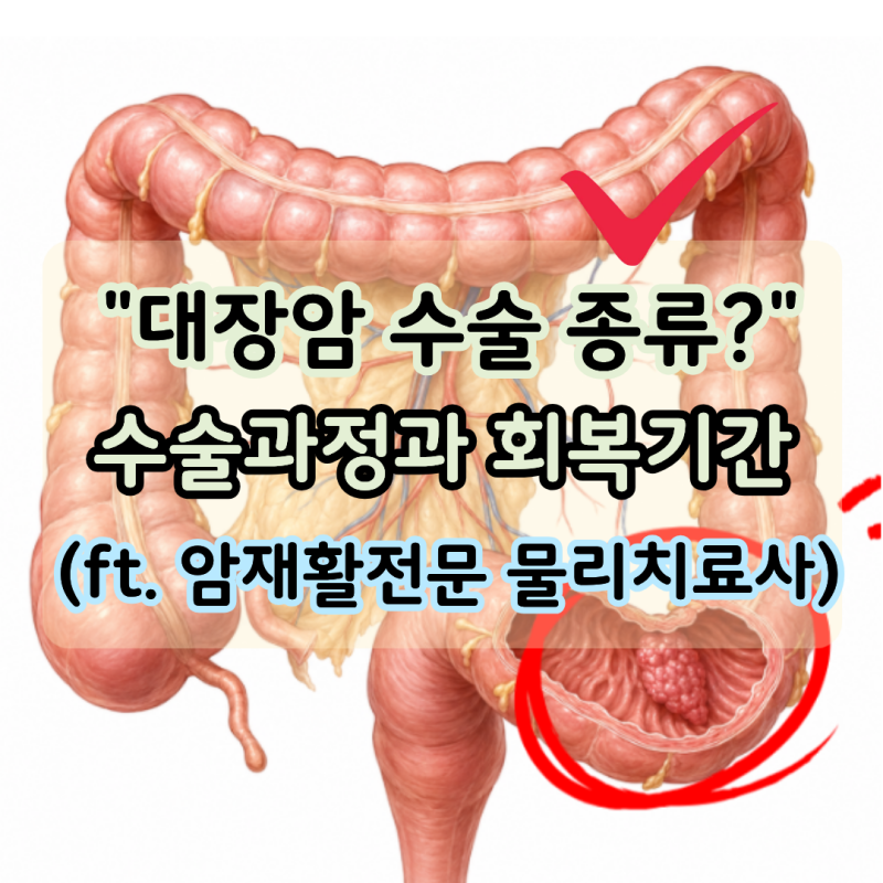 대장암 수술 종류 5가지?, 장루 수술 과정까지 (ft. 암재활전문 물리치료사)