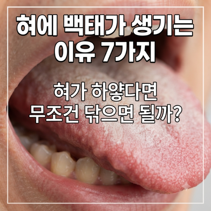 혀에 백태가 생기는 이유 7가지, 혀가 하얗다면 무조건 닦으면 될까?