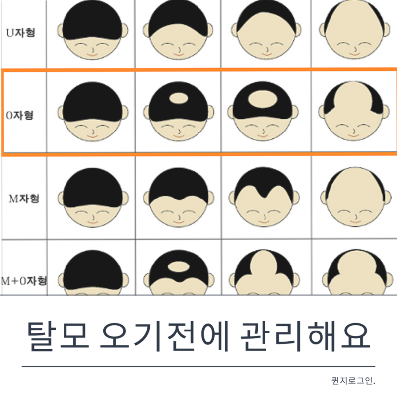 두피샴푸 추천, 르네휘테르로 건강한 두피 관리 시작해요