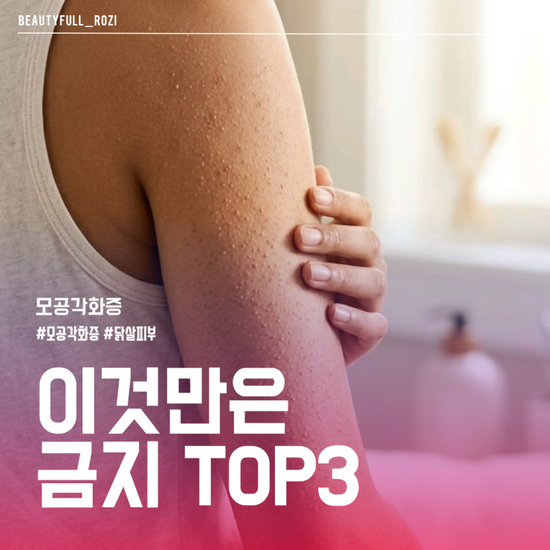 팔 다리 등 닭살피부 모공각화증인 사람들은 모르는 치명적인 실수 3가지