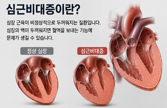 이용주 심장마비로 별세…과거 앓았던 심근비대증은 어떤 병?