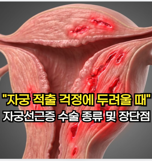 자궁선근증 증상 "자궁 적출 걱정에 두려울 때" 자궁선근증 수술 종류 및 장단점