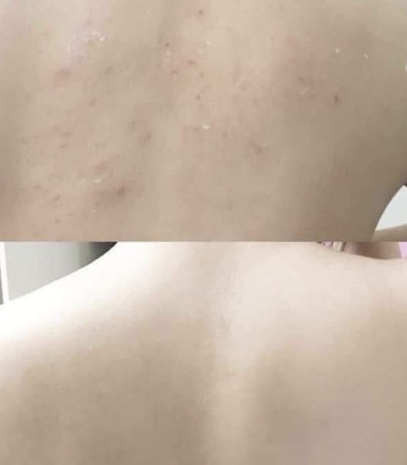 메디톨드 퍼시닌 바디워시, 등드름, 체취에 효과좋은 바디워시